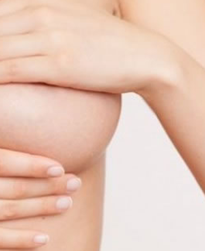 ¿Cómo están formadas tus lolas?