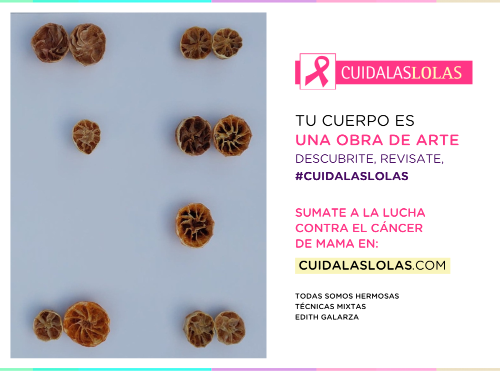 Todas somos hermosas
